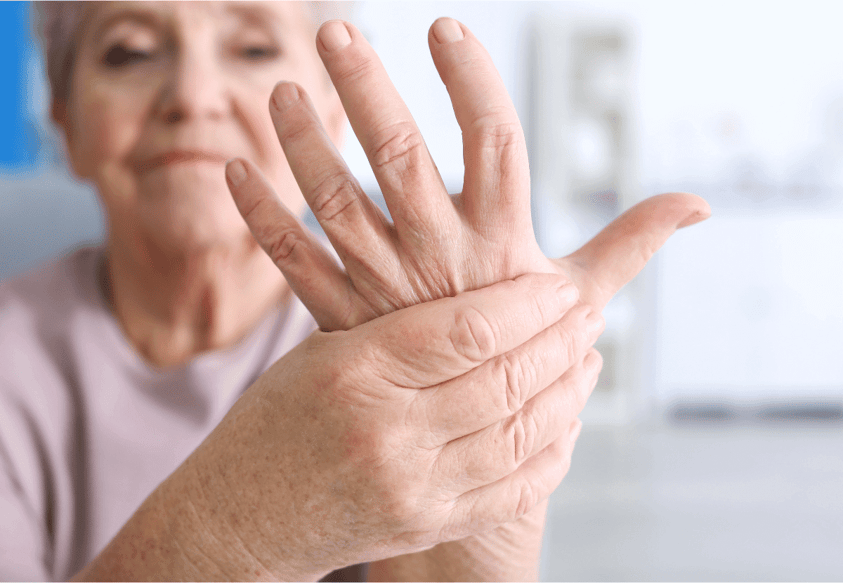 rheumatoid-arthritis-autoimmune-disease